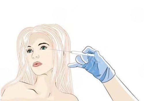 玻尿酸填充太陽凹大概多少錢？