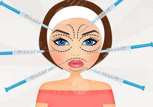 玻尿酸填充太陽凹大概多少錢？