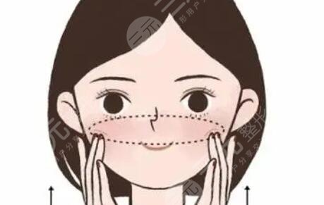 內(nèi)輪廓固定