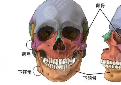 臉部骨骼變形能矯正嗎？