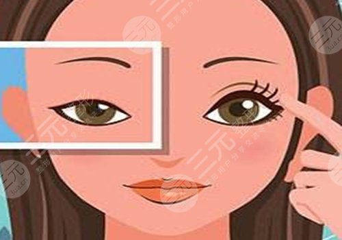 做眼部提拉手術能維持多久？