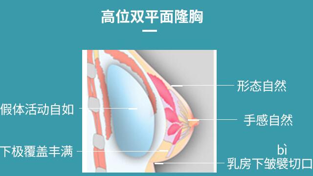 下皺襞隆胸多久恢復(fù)正常，要注意什么？術(shù)前必備科普指南！