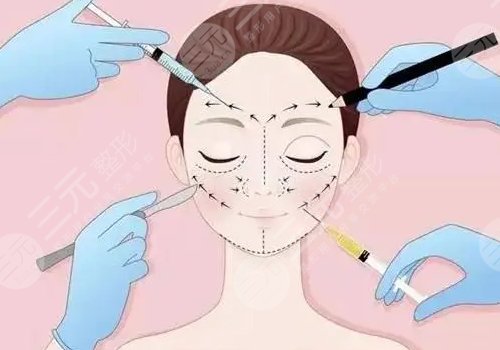 臉部輪廓固定要多少錢一次呢？