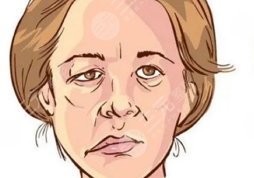 嘴巴歪整形大概多少錢？