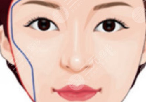 面部輪廓固定怎么做？