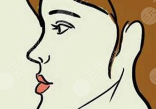 月亮臉矯正手術(shù)多少錢？
