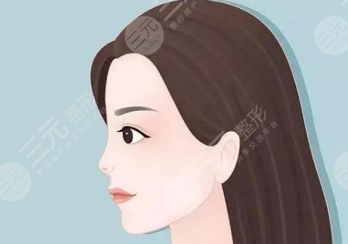 黑金dpl超光子嫩膚效果怎么樣