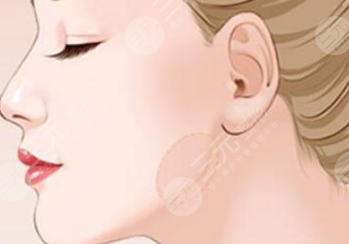 黑金dpl超光子嫩膚效果怎么樣