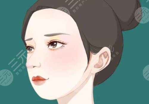 黑金dpl超光子嫩膚效果怎么樣