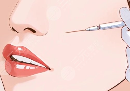 臉部外輪廓固定填充什么？