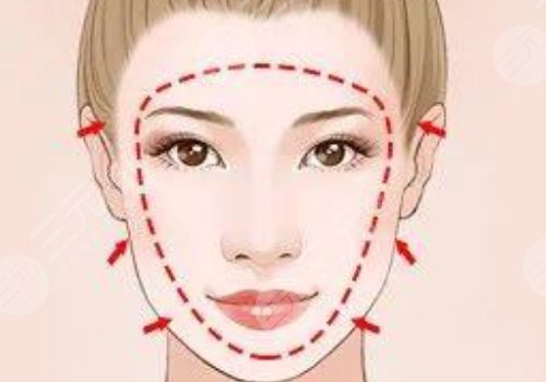 外輪廓包括哪些部位？