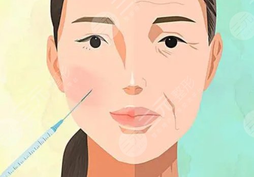 打緊致提升針有用嗎？