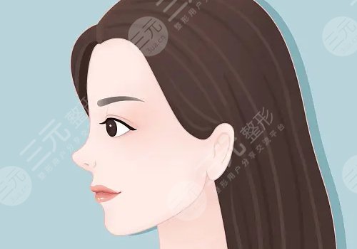 內(nèi)輪廓和外輪廓的位置圖片