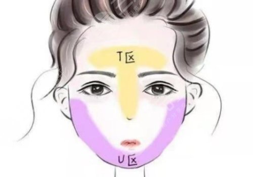 面部外輪廓固定怎么做？