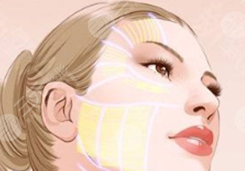 面部外輪廓固定怎么做？