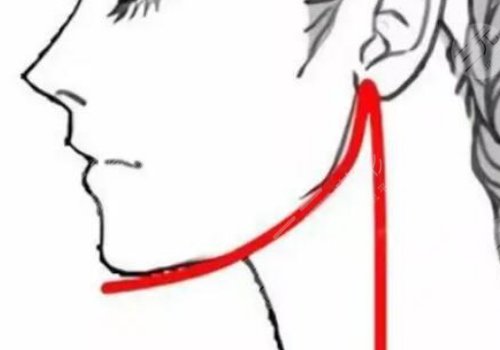 面部外輪廓固定怎么做？