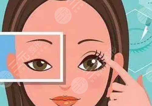腫眼泡怎么消除？