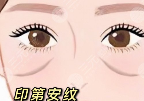 印第安紋和淚溝的區(qū)別是什么？