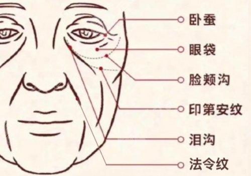 印第安紋和淚溝的區(qū)別是什么？