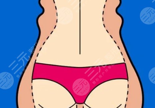 腰腹環(huán)吸大概多少錢(qián)