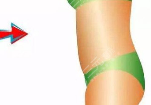 腰腹環(huán)吸大概多少錢(qián)