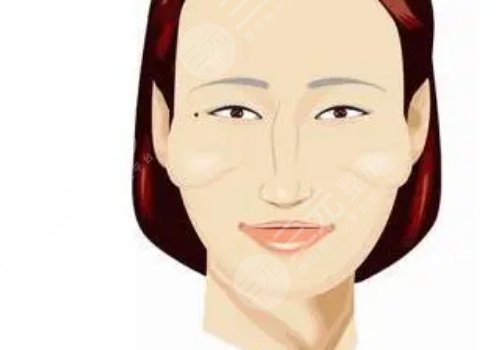 顴骨高怎么改良臉型？