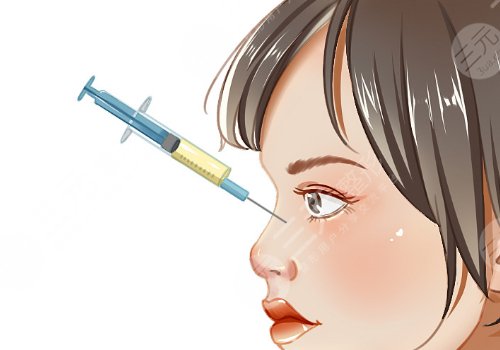 濡白天使隆鼻維持多久？