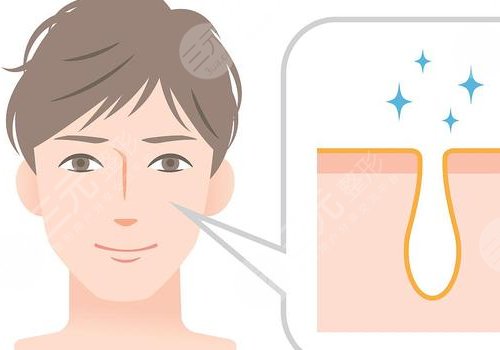 t區(qū)反復(fù)長(zhǎng)痘痘的原因是什么？