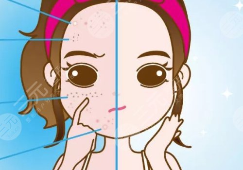t區(qū)反復(fù)長(zhǎng)痘痘的原因是什么？
