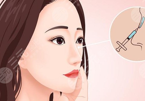 寶尼達隆鼻可以維持多久？