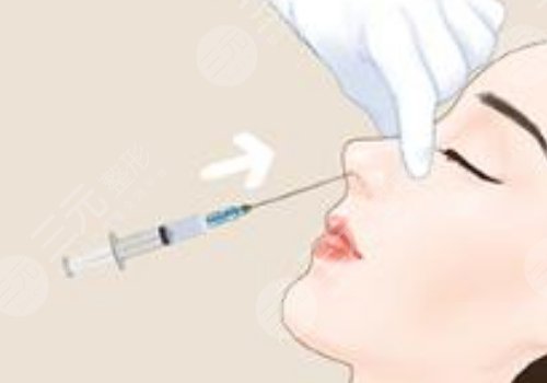 寶尼達隆鼻可以維持多久？