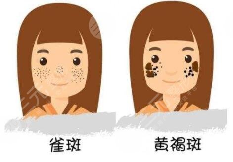 上海九院祛斑能完全去掉嗎?