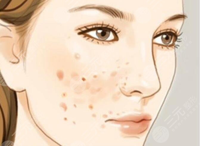 上海九院祛斑案例分享