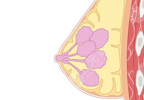哪種胸型更好看？