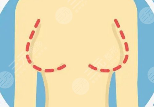 哪種胸型更好看？