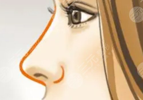 媽生鼻多少錢(qián)