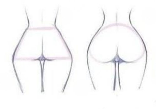 假體豐臀需要多少錢？