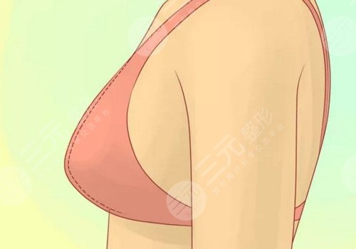 胸型不好看可以調(diào)整嗎？