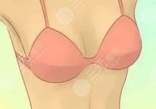 胸型不好看可以調(diào)整嗎？