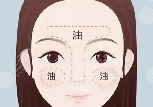 t區(qū)出油毛孔粗大怎么辦？