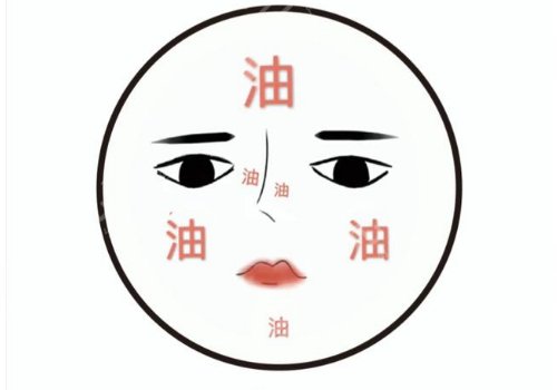t區(qū)出油毛孔粗大怎么辦？