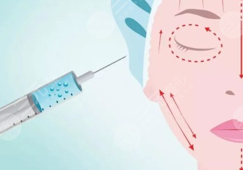 外輪廓固定提升有哪些手術方案？