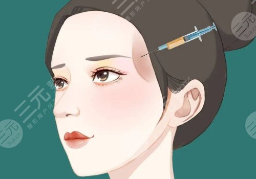 外輪廓提升需要幾支玻尿酸？