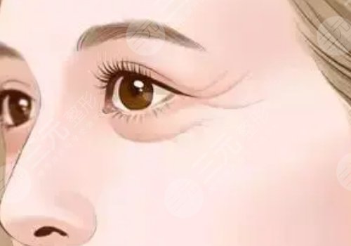 薇旖美可以注射眼部周圍的皺紋不？