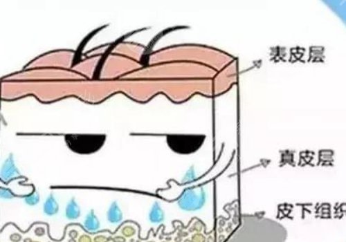 玻尿酸豐胸優(yōu)缺點