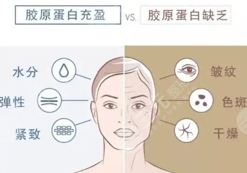 膚美達(dá)和雙美的區(qū)別