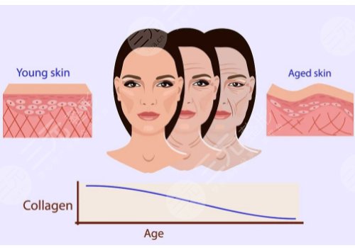 膚美達(dá)和雙美的區(qū)別