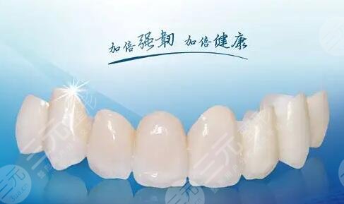 烤瓷牙多少錢一顆價格表2023查詢!牙齒修復必備~