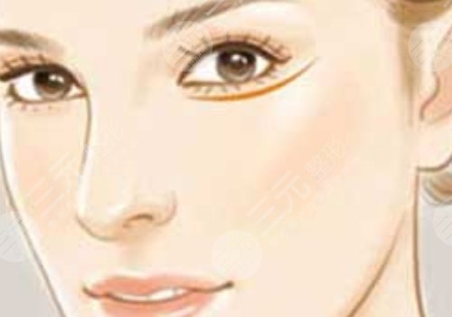 整鼻子鼻翼縮小多少錢