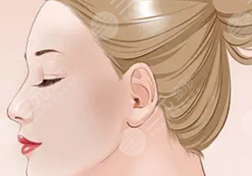 整鼻子鼻翼縮小多少錢